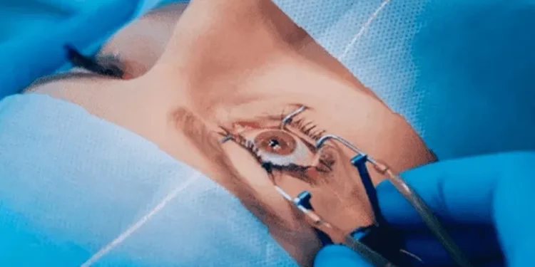 Cataract Surgery in Mumbai